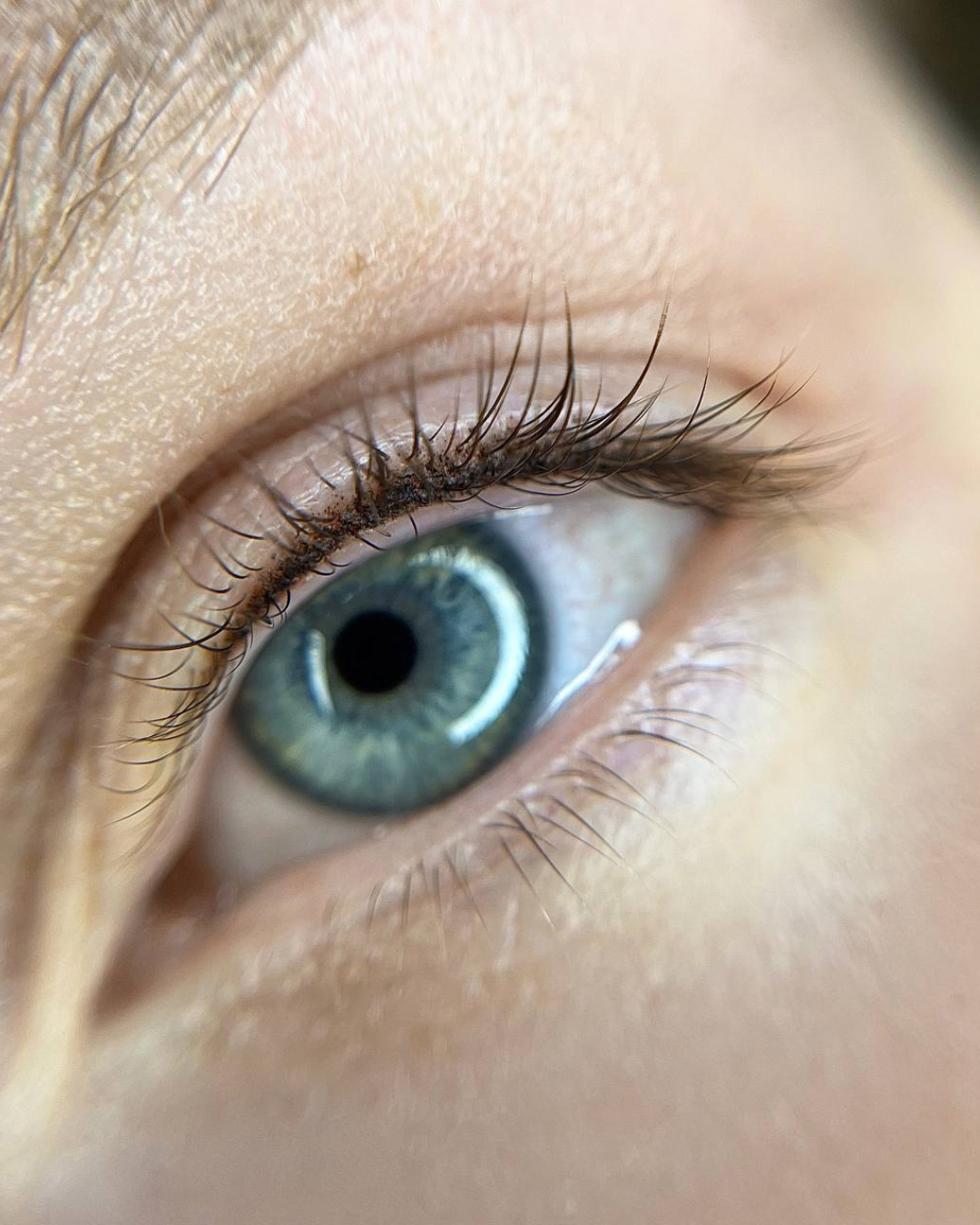 Wimpernkranzverdichtung — wacher, offener Blick