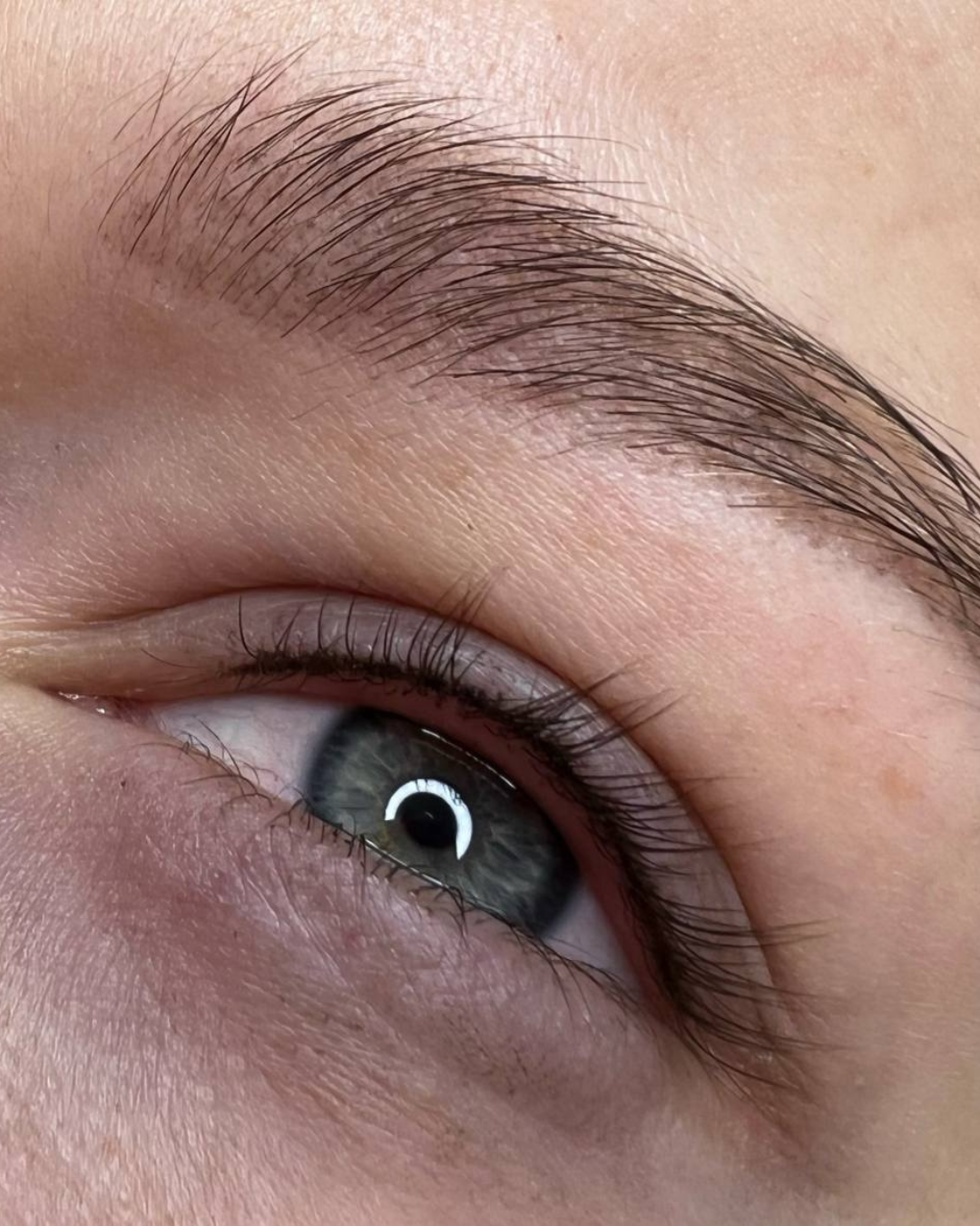Ergebnis Wimpernkranzverdichtung